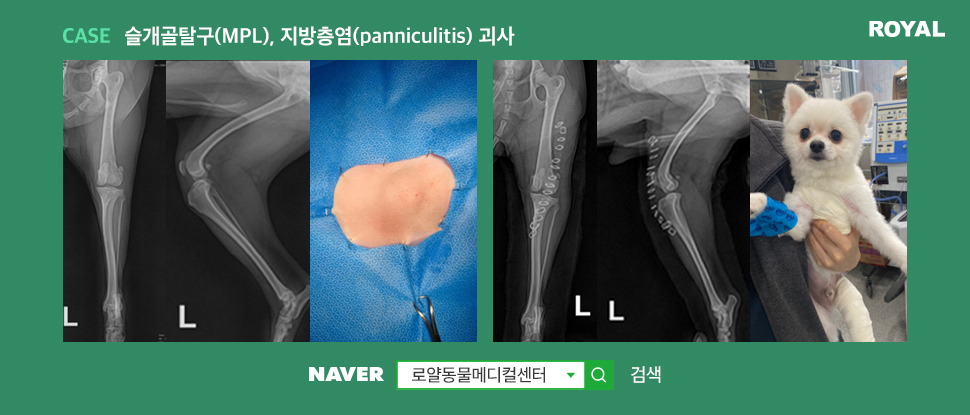 슬개골탈구