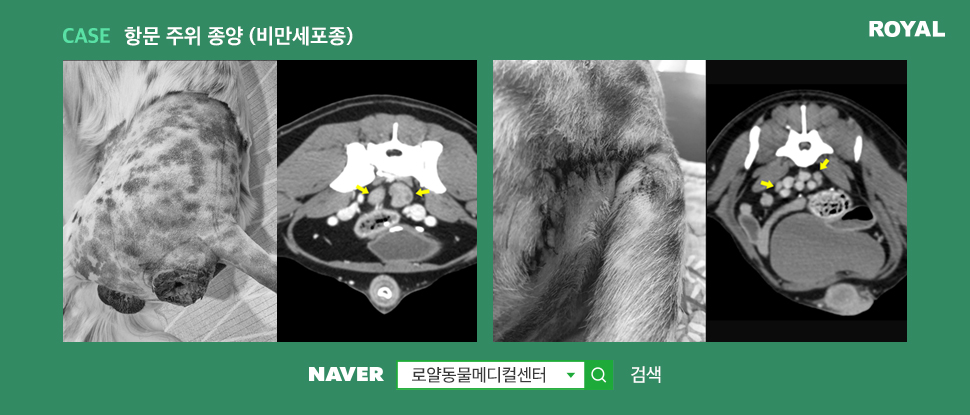 항문 주위 종양