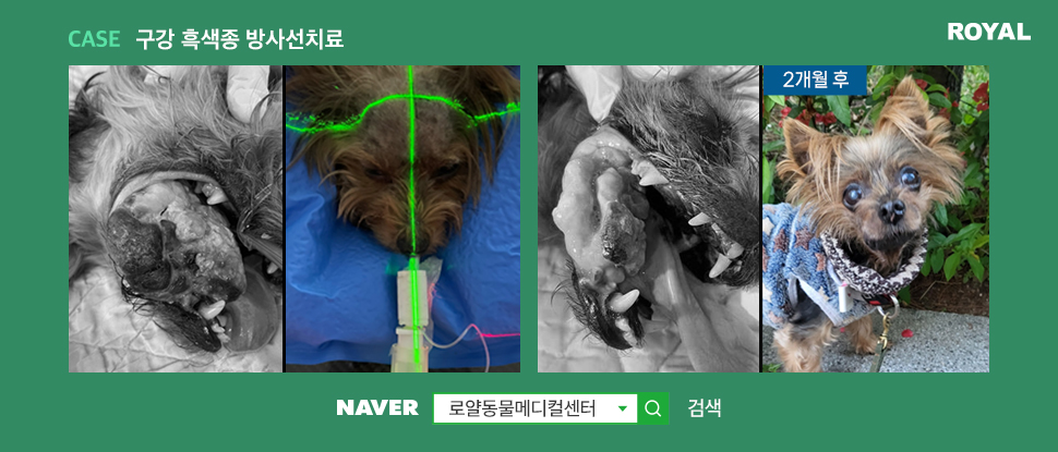 구강흑색종